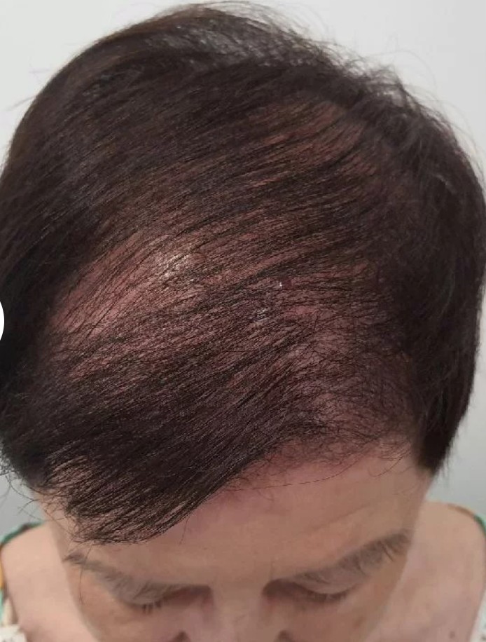 Después del tratamiento detox capilar marino con cabello revitalizado y más densidad en El Tocador de Olivia peluquería Benimaclet Valencia